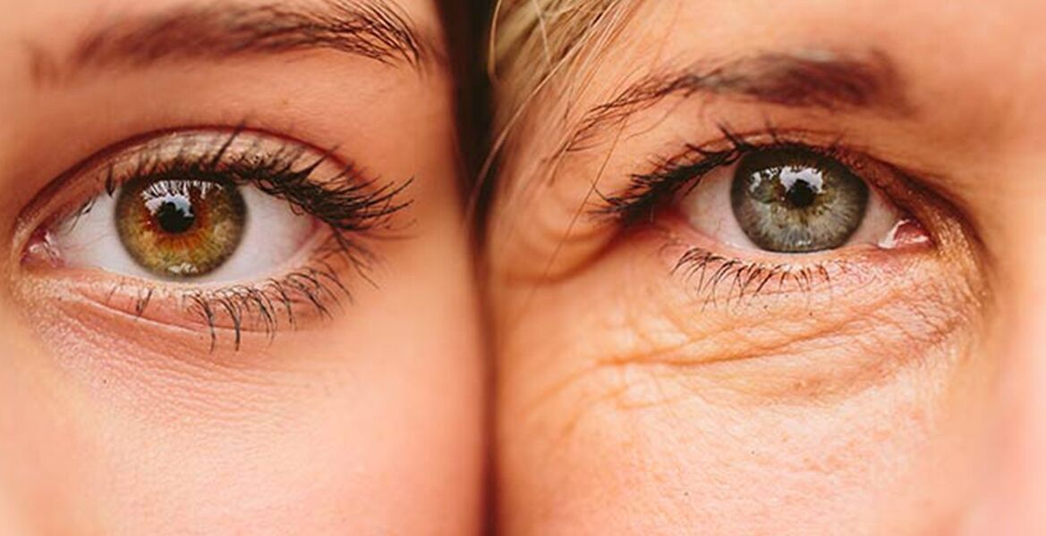 Zewnętrzne oznaki starzenia się skóry wokół oczu u dwóch kobiet w różnym wieku